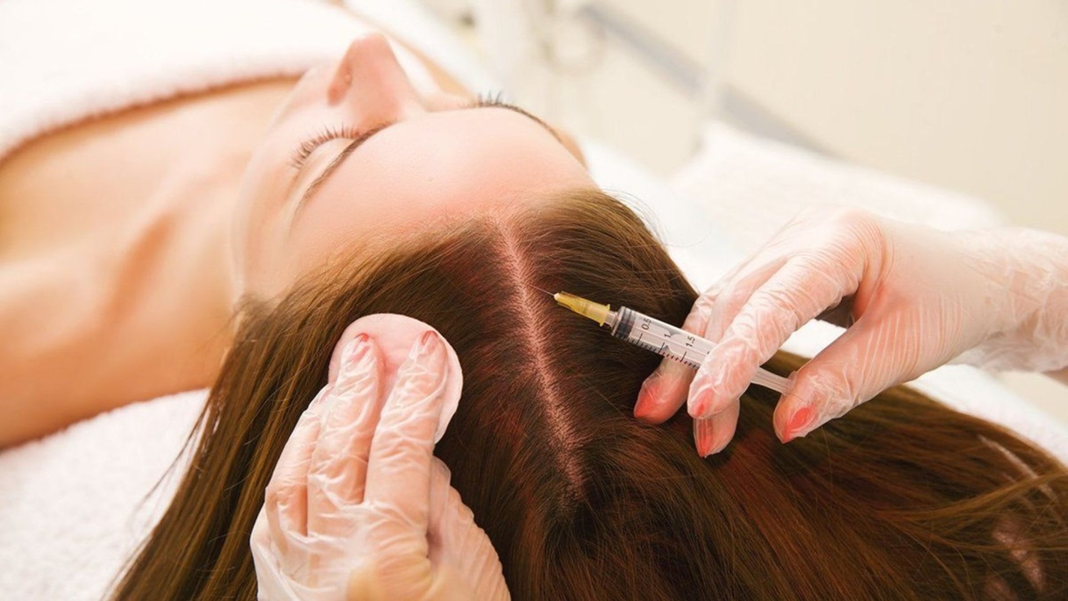 Мезотерапия для роста и профилактики выпадения волос.